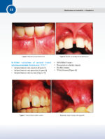 Classifications in Periodontics - A Compilation 2024 - Image 5