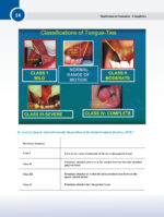 Classifications in Periodontics - A Compilation 2024 - Image 6