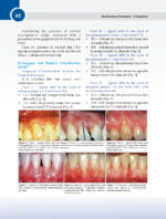 Classifications in Periodontics - A Compilation 2024 - Image 7