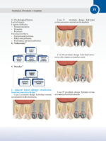 Classifications in Periodontics - A Compilation 2024 - Image 8