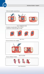 Classifications in Periodontics - A Compilation 2024 - Image 2