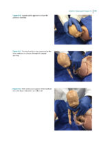 Dental Management of the Pregnant Patient - Image 5