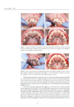 3D Printed Materials Dentistry 2023 - Image 2