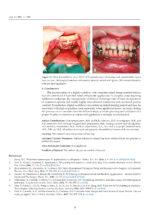 3D Printed Materials Dentistry 2023 - Image 3