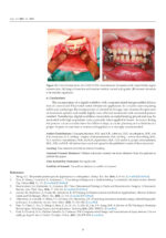 3D Printed Materials Dentistry 2023 - Image 3