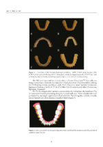 3D Printed Materials Dentistry 2023 - Image 4