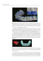 3D Printed Materials Dentistry 2023 - Image 5