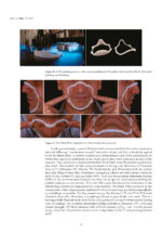 3D Printed Materials Dentistry 2023 - Image 6