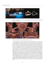 3D Printed Materials Dentistry 2023 - Image 6