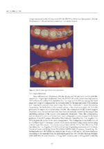 3D Printed Materials Dentistry 2023 - Image 7