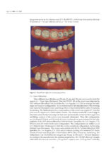 3D Printed Materials Dentistry 2023 - Image 7