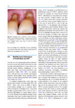 Dentine Hypersensitivity: Advances in Diagnosis, Management, and Treatment 2024 (2nd Edition) - Image 3