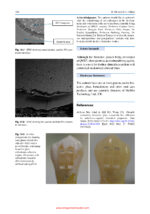 Dentine Hypersensitivity: Advances in Diagnosis, Management, and Treatment 2024 (2nd Edition) - Image 8