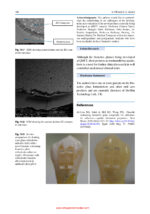 Dentine Hypersensitivity: Advances in Diagnosis, Management, and Treatment 2024 (2nd Edition) - Image 8