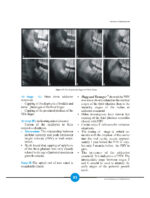 Growth Indicators In Orthodontics 2026 - Image 2