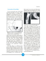 Growth Indicators In Orthodontics 2026 - Image 6