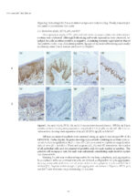 Oral Cancer Prophylaxis, Etiopathogenesis and Treatment 2025 - Image 3