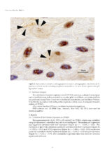 Oral Cancer Prophylaxis, Etiopathogenesis and Treatment 2025 - Image 4