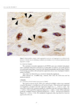 Oral Cancer Prophylaxis, Etiopathogenesis and Treatment 2025 - Image 4