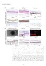 Oral Cancer Prophylaxis, Etiopathogenesis and Treatment 2025 - Image 10