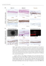 Oral Cancer Prophylaxis, Etiopathogenesis and Treatment 2025 - Image 10