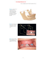 Practical Applications in Dental Occlusion: Analog to Digital 2024 - Image 2