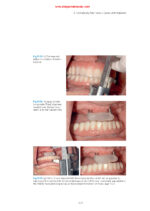 Practical Applications in Dental Occlusion: Analog to Digital 2024 - Image 3