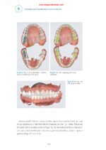 Practical Applications in Dental Occlusion: Analog to Digital 2024 - Image 4