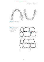 Practical Applications in Dental Occlusion: Analog to Digital 2024 - Image 5