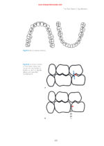 Practical Applications in Dental Occlusion: Analog to Digital 2024 - Image 5