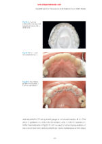 Practical Applications in Dental Occlusion: Analog to Digital 2024 - Image 6