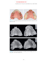 Practical Applications in Dental Occlusion: Analog to Digital 2024 - Image 7