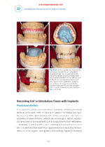 Practical Applications in Dental Occlusion: Analog to Digital 2024 - Image 8
