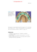 Practical Applications in Dental Occlusion: Analog to Digital 2024 - Image 9