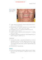 Practical Applications in Dental Occlusion: Analog to Digital 2024 - Image 10