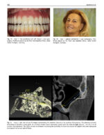 Perspectives on Zygomatic Implants 2021 - Image 9