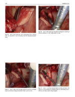 Perspectives on Zygomatic Implants 2021 - Image 8