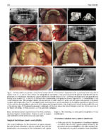 Perspectives on Zygomatic Implants 2021 - Image 7