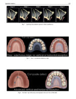 Perspectives on Zygomatic Implants 2021 - Image 5
