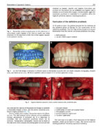 Perspectives on Zygomatic Implants 2021 - Image 3