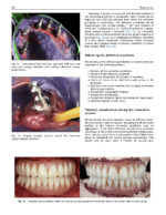 Perspectives on Zygomatic Implants 2021 - Image 10