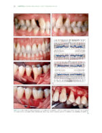 The Ortho-Perio Patient: Clinical Evidence and Therapeutic Guidelines 2019 - Image 9