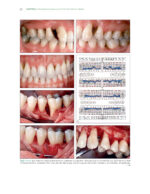 The Ortho-Perio Patient: Clinical Evidence and Therapeutic Guidelines 2019 - Image 9