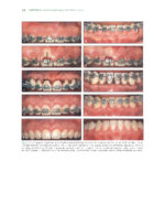 The Ortho-Perio Patient: Clinical Evidence and Therapeutic Guidelines 2019 - Image 10