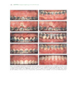 The Ortho-Perio Patient: Clinical Evidence and Therapeutic Guidelines 2019 - Image 10