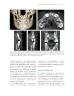 The Ortho-Perio Patient: Clinical Evidence and Therapeutic Guidelines 2019 - Image 11