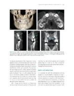 The Ortho-Perio Patient: Clinical Evidence and Therapeutic Guidelines 2019 - Image 11