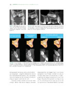 The Ortho-Perio Patient: Clinical Evidence and Therapeutic Guidelines 2019 - Image 12