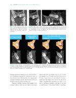 The Ortho-Perio Patient: Clinical Evidence and Therapeutic Guidelines 2019 - Image 12