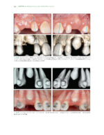 The Ortho-Perio Patient: Clinical Evidence and Therapeutic Guidelines 2019 - Image 2